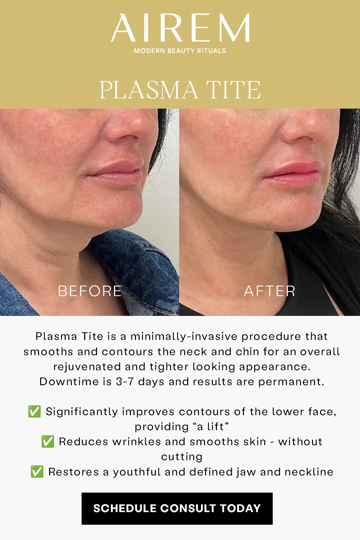 4x6 PlasmaTite Exclusives - Airem Modern Beauty Rituals