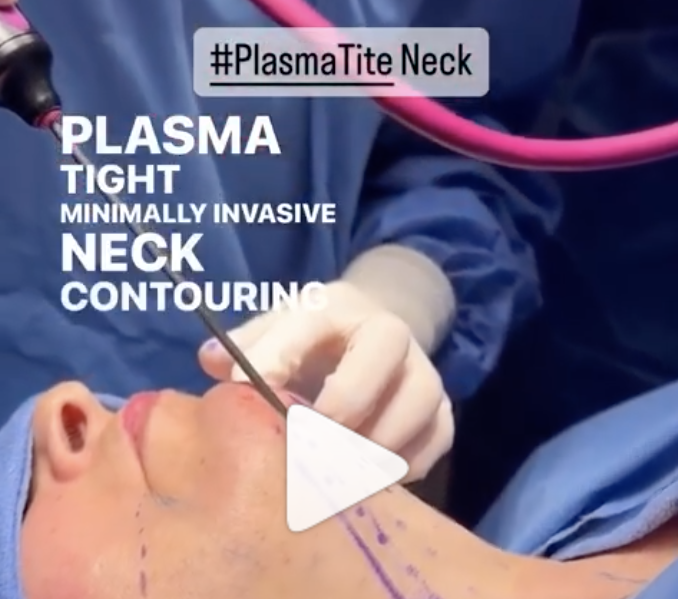 neck tightening AIREM