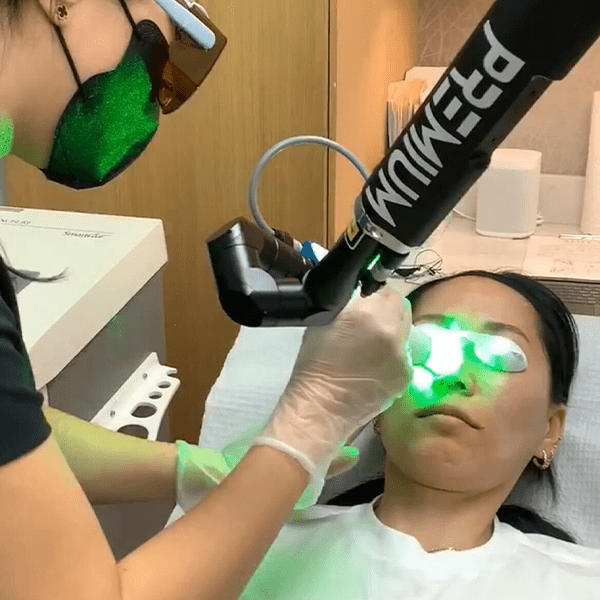 Which Laser Resurfacing Treatment Is Right For You?