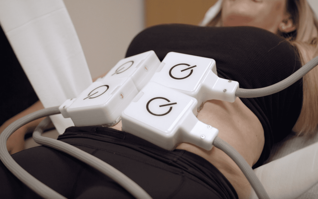 BODYFIT BY PHYSIQ: THE NEW NON-SURGICAL BODY CONTOURING TREATMENT