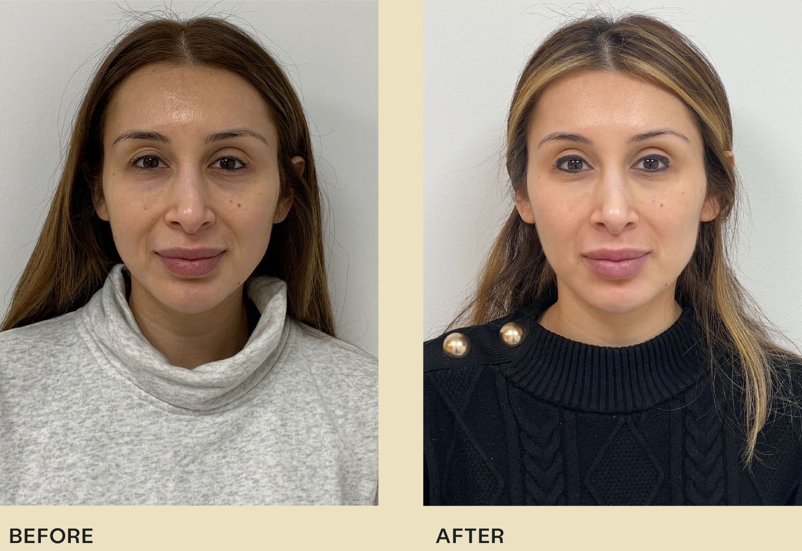 ADVANCED SKIN REJUVENATION WITH THESE NEW LASER RESURFACING TREATMENTS